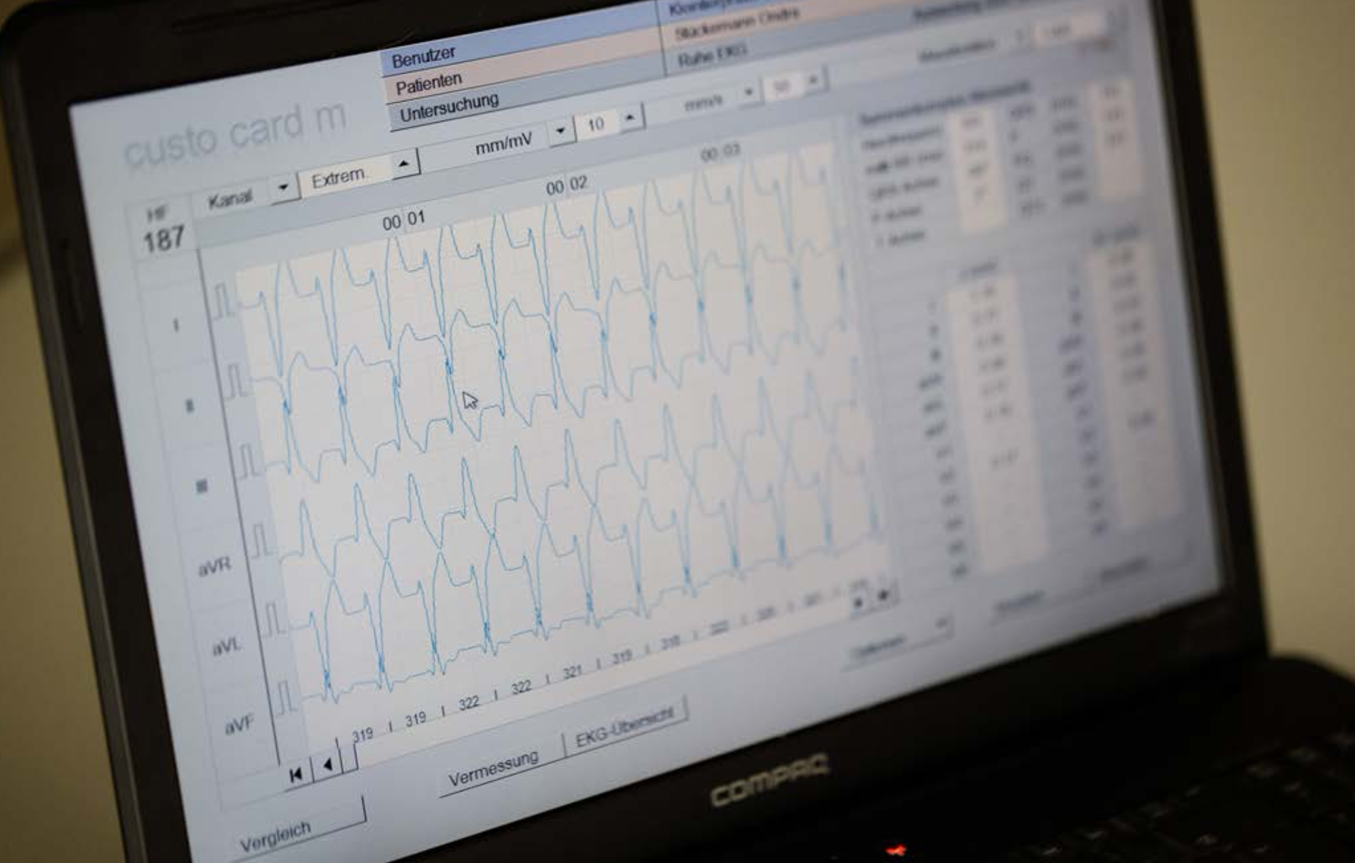 Medizinische Ausstattung - Computermonitor mit Daten